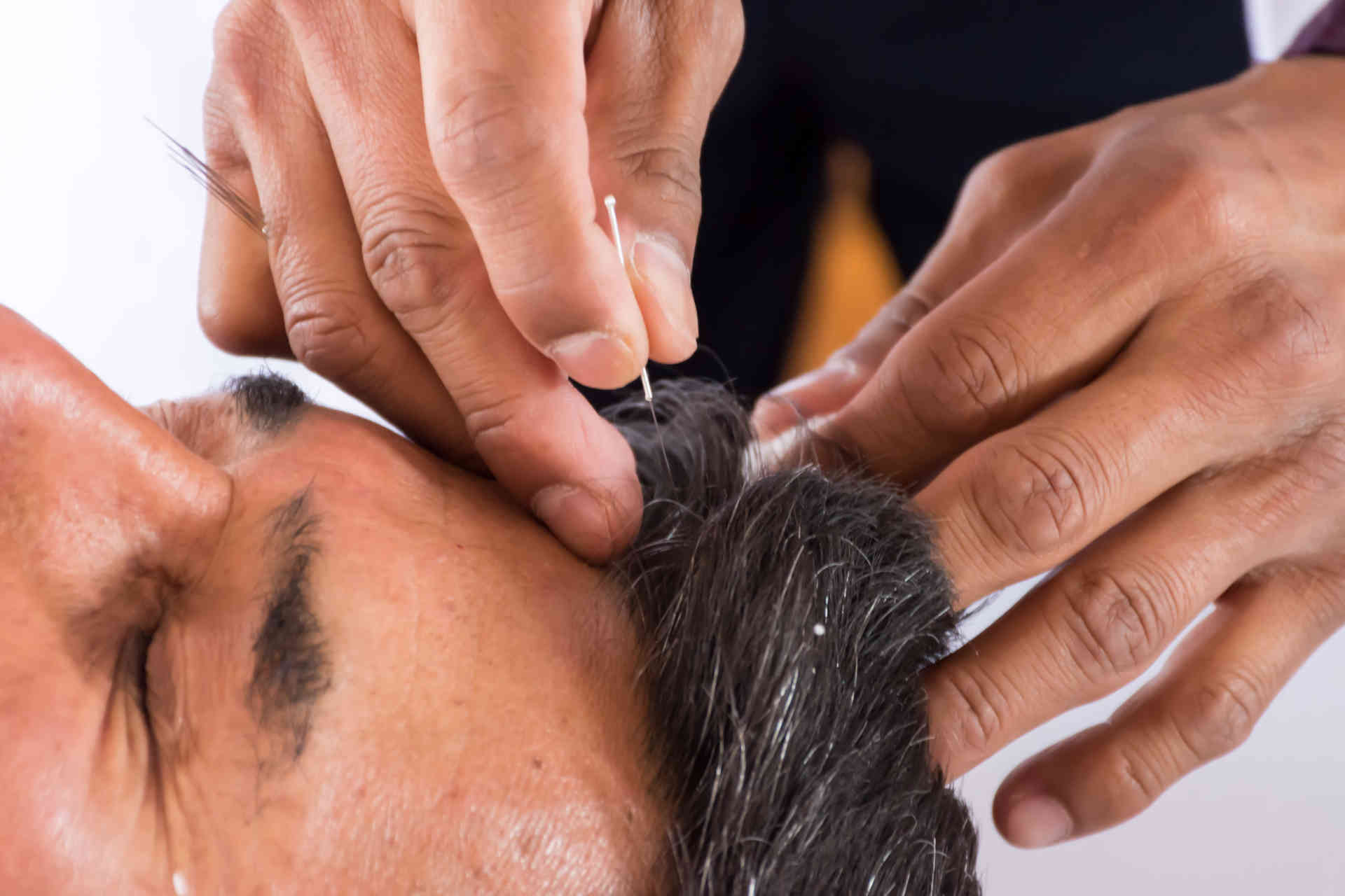 Diplomatura en Terapeuta en Acupuntura