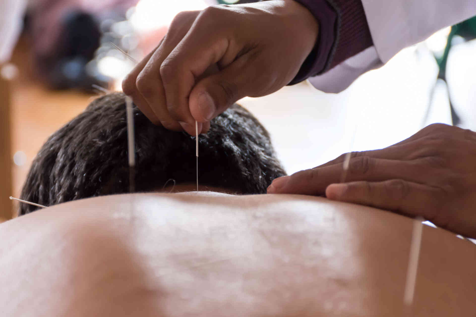 Diplomatura en Terapeuta en Acupuntura