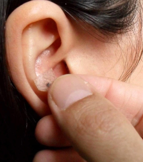 Curso en Auriculoterapia y Conoterapia